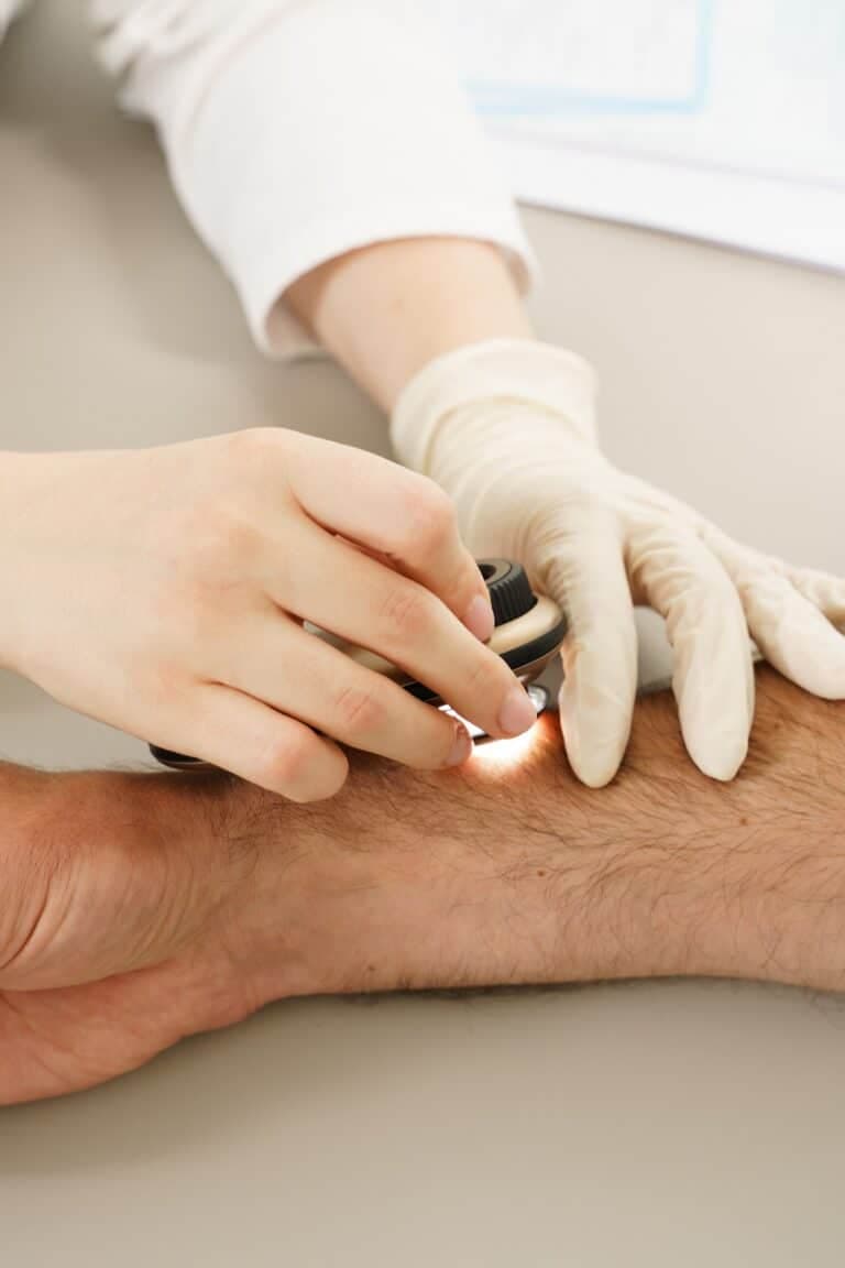 Melanoma optimal care pathway